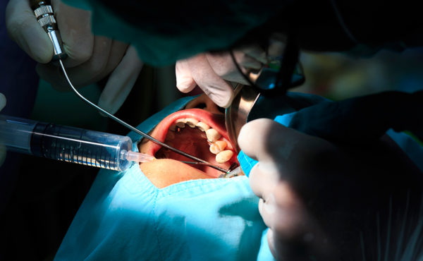 Cirugía bucal y ortodoncia